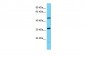 ARMT1 Antibody - N-terminal region